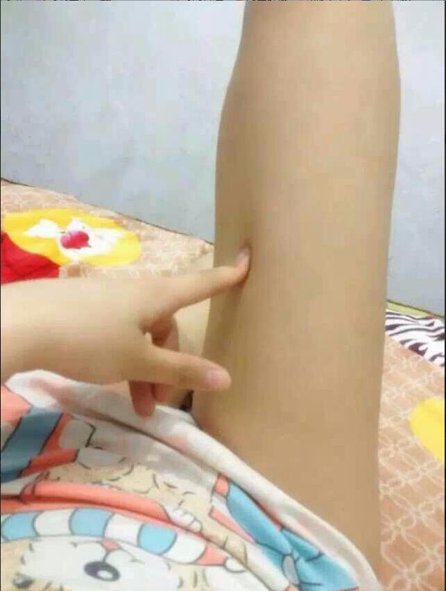 张家边彤彤 第1张